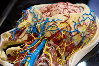 В Татарстане снижается заболеваемость болезнями системы кровообращения