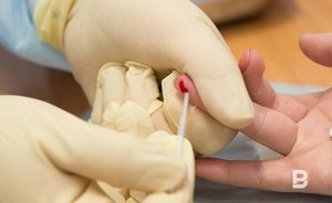 В пандемийный год в Татарстане снизилась заболеваемость ВИЧ — но упало и число тестов