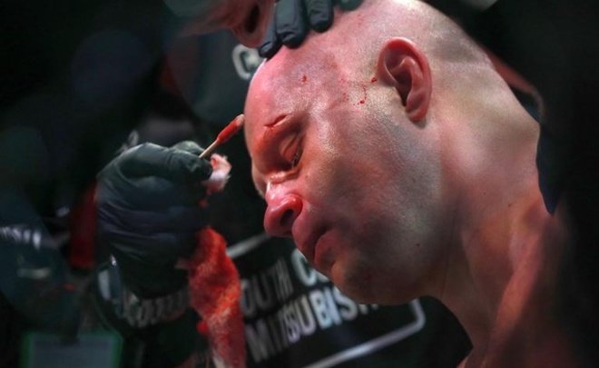 Федор Емельяненко рассказал о своем состоянии после нокаута