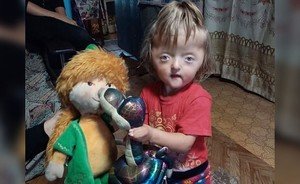 Власти Башкирии отправят на лечение в Москву девочку, которую не взяли в детский сад из-за дефектов черепа