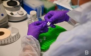 В Великобритании зафиксировали случай заражения человека оспой обезьян