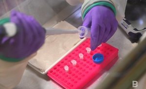 Ученый КФУ разрабатывает тест-систему для диагностики травм спинного мозга