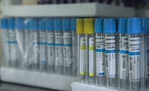 Минздрав России может одобрить еще один препарат для лечения COVID-19